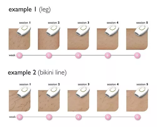 Depiladora láser Ipl permanente